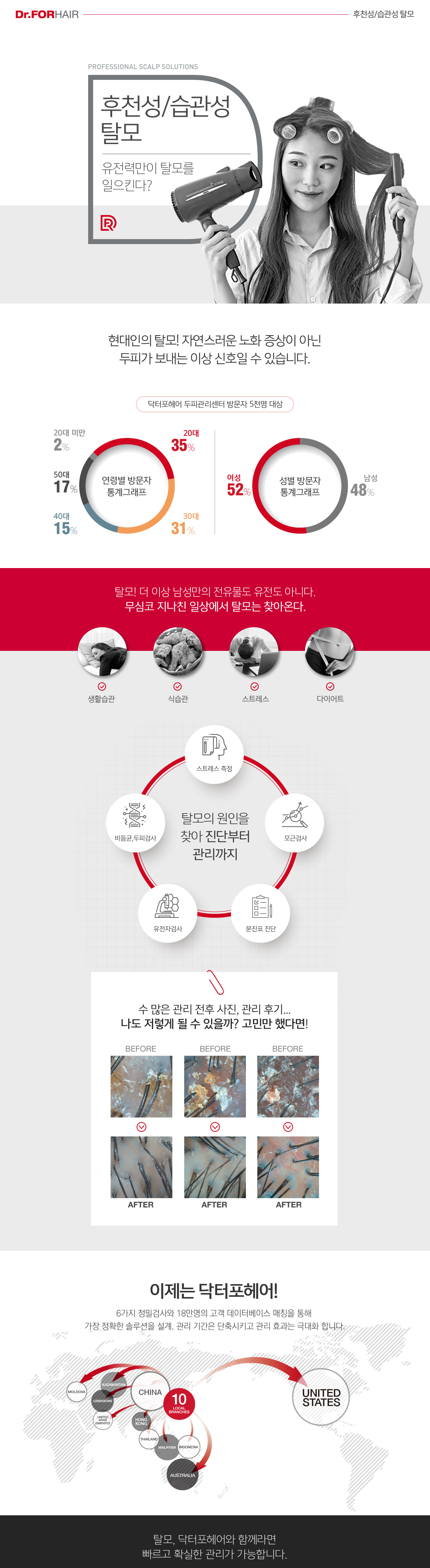 후천적습관성탈모