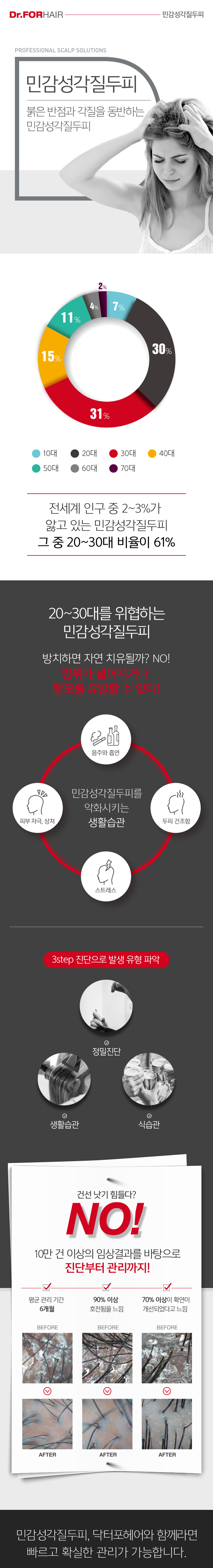 민감성각질두피